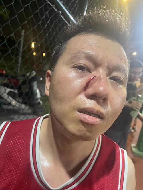 太狠了！击打邹雨宸面部 弄伤萨林杰，网友:这是打球？这是废人呀